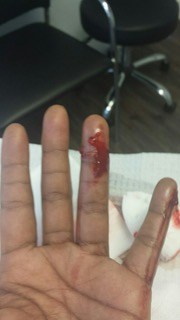 wound with blood on ring finger